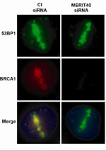 BRCA1 (red) readily localizes to laser-induced DNA damage sites demarcated by the DNA repair protein (green) in control cells (left column). BRCA1 recruitment to DNA damage sites is strongly reduced in MERIT40-deficient cells (right column)